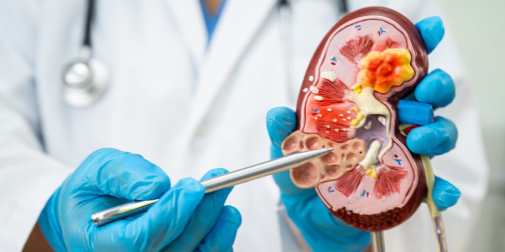 Urology Department uddy74byott7jyuzsvfzvrrabjkt0asxyowf50jx
